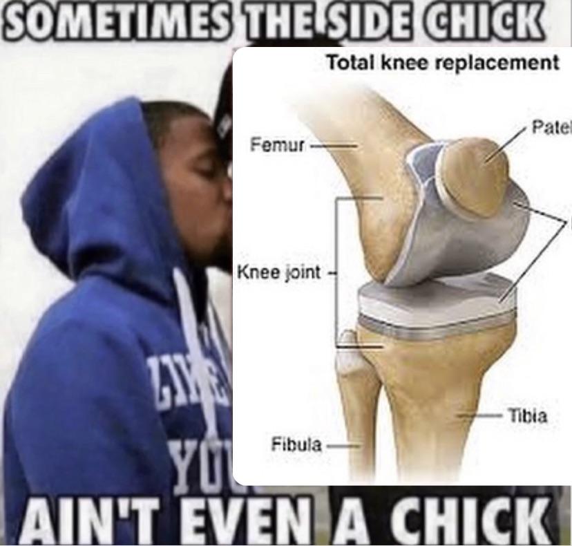 knee surgery memes