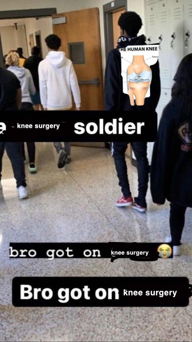 knee surgery memes