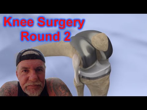 knee surgery memes